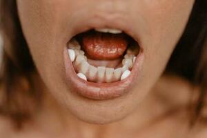 Abortion pills in Jeddah 💊 (+966572737505)💊 Get Cytotec 