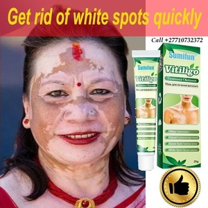 Get Rid Of Vitiligo In Kiester City in Minnesota +27710732372 Scars And Stretch Marks In Lybster Village in Scotland