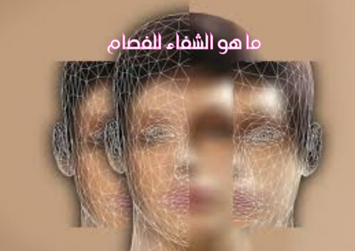 كيف يمكن علاج الاضطرابات النفسية أو الفصام